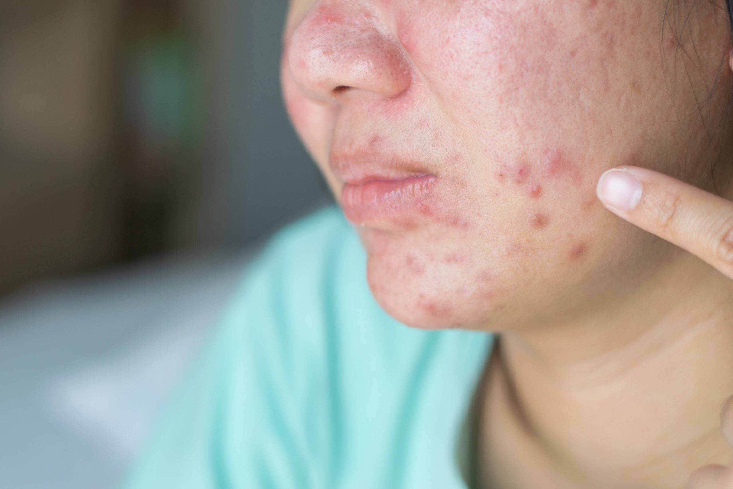 Different Skin Problems and How to Treat It